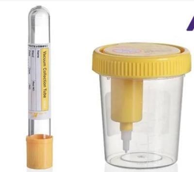 Disposable Medical Plastic Urine Cup with Various Sizes