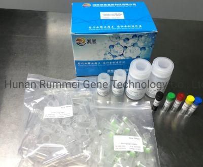 Influenza a H11 Subtype Nucleic Acid Detection Kit (fluorescence PCR)