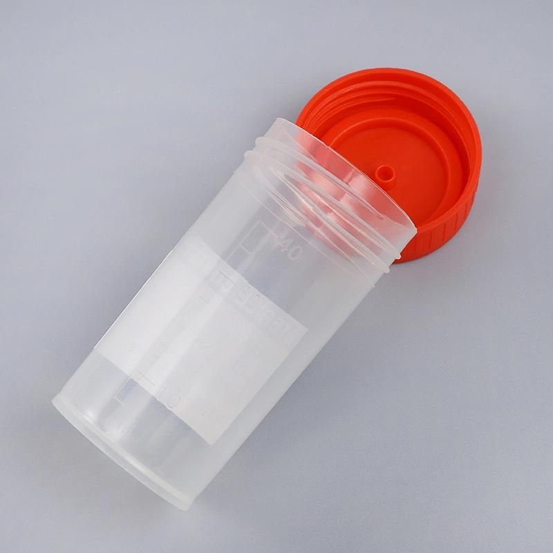 Individual Packing Test 40ml Medical Urine and Stool Containers