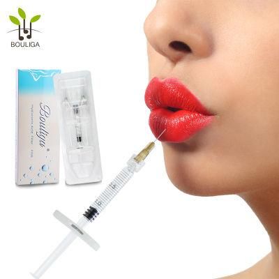 Hyaluronic Acid Dermal Filler for Lip Fullness 2ml
