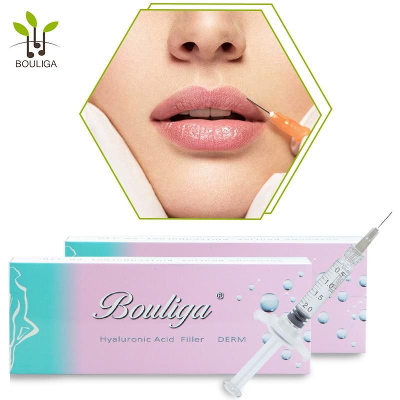 1ml 2ml Crosslinked Ha Dermal Filler for Lips Enhance