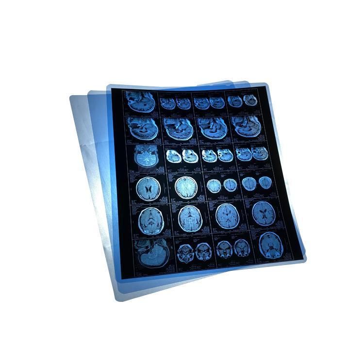 Medical Printing Radiology Universal Dry Film / 14*17 Inch Medical Blue Thermal Film/X-ray Printer