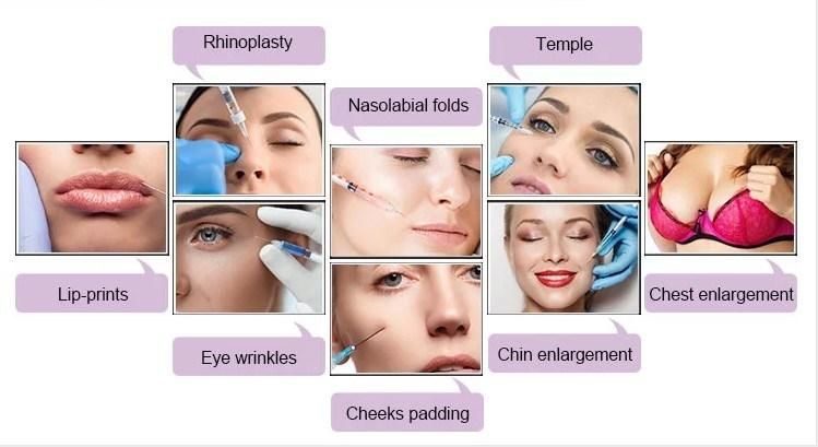 Beauty Products Injection Filler Ha Filler Rejeunesse Lip Enlargement