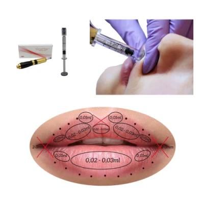 Hyaluronic Pen Hyaluronic Acid Dermal Filler Injector for Lips
