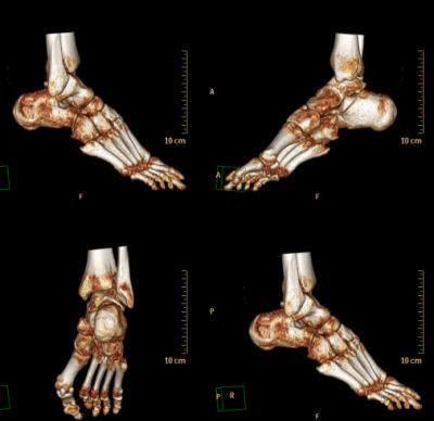 Inkjet Medical X-ray Film of Hospitals Radiology Consumables