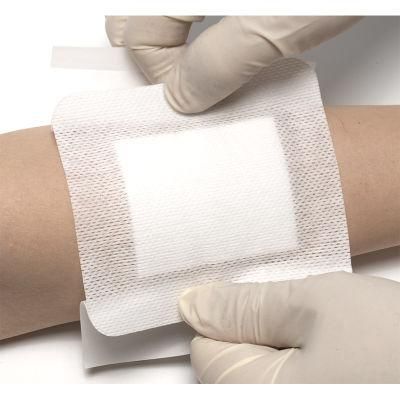 Consumable Sterile Non-Woven Adhesive Wound Island Dressing