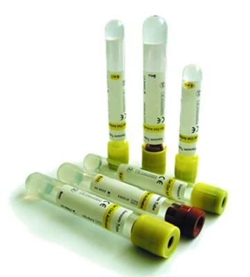 Disposable Gel Vacuum Blood Collecion Tubes