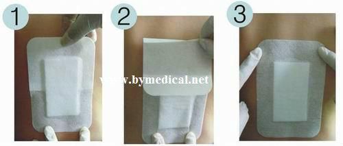 Sterile Non Woven Adhesive Wound Dressing Plaster