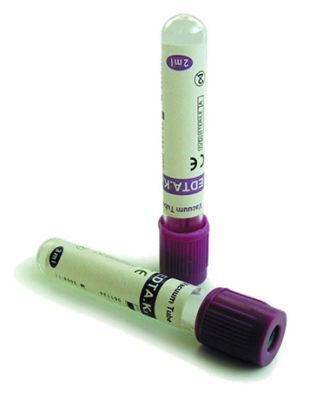 EDTA Vacuum Blood Collection Tube