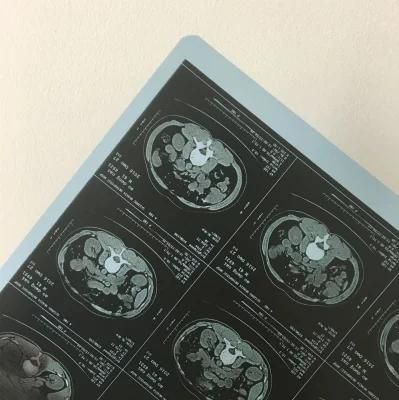 Hospital 8*10, 10X12, 11X14 and 14X17 Inch Medical X-ray Film