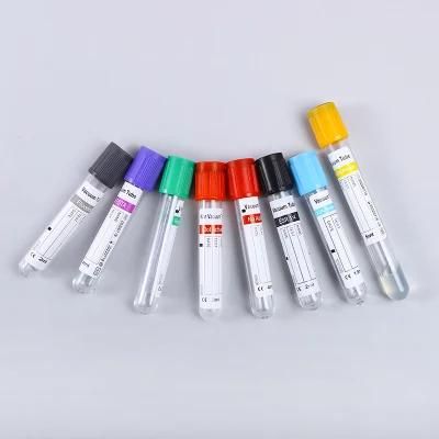High Quality Various Colorful Sample Blood Collection Tubes Types