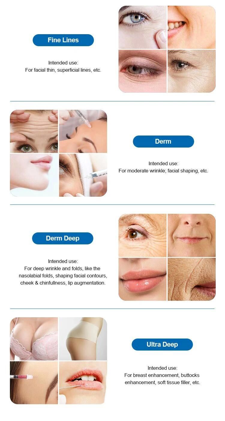Manufutuer Price 5 Ml Facial Wrinkles Resistance Hyaluronic Acid Filler