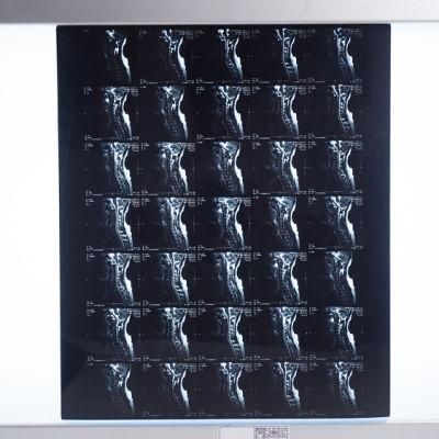 35X43cm Blue Thermal X Ray Film for Agfa/Kodak/FUJI Printer