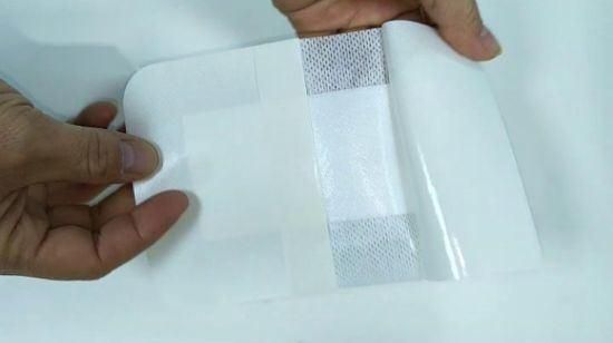 Mdr CE Approved Adhesive Nonwoven Medical Equipment Wound Dressing for Patient