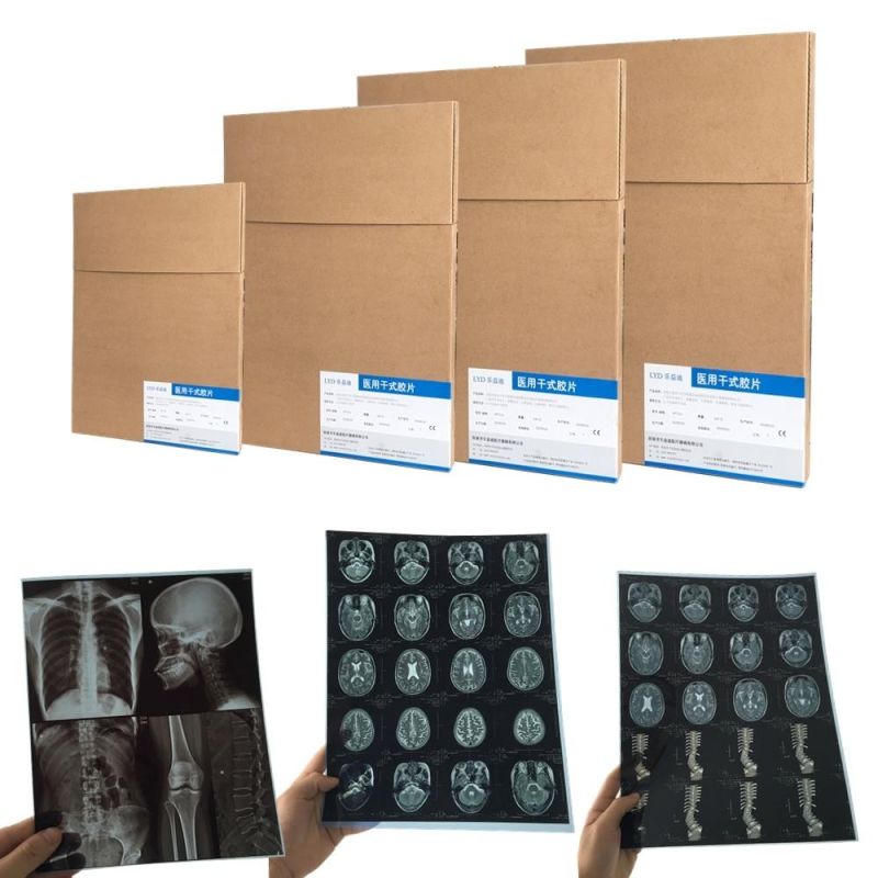 CT and MRI Medical X-ray Film Inkjet Printing Film 8X10 Inch
