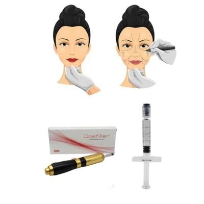 Cross-Linked Hyaluronic Acid Injectable Dermal Filler for Wrinkle Removal /Skin Tighten