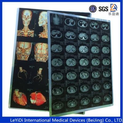 Hospital Use Radio Graphic Medical X-ray Film Imaging