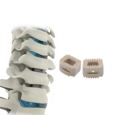 Medical Products Orthopedic Implant Medical Cervical Peek Cage