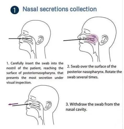Disposable Medical Supply Vtm Tube with Nasal Swab FDA Certified 2ml 5ml 10ml