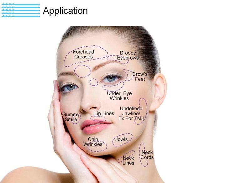 High Quality Low Temperature Storage Remove Forehead Wrinkles Botulinumex Toxin