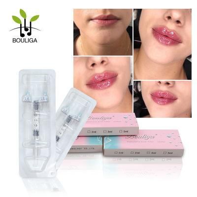 Injectable Cross Linked Dermal Filler 2ml for Lips