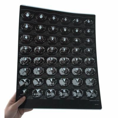 28X35 Dry Imaging Inkjet Blue Medical Xray Film for MRI