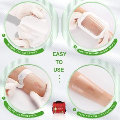 Wound Care Waterproof Transparent Dressing