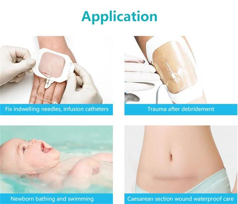 Disposable Transparent Film Dressing IV Wound Dressing