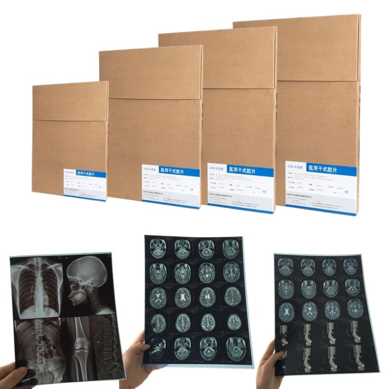 White and Blue A4 and 8X10 Inch Medical X-ray Film Ultrasound Inkjet Film
