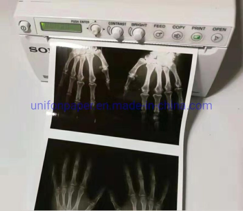 MD400 Ultrasound Machine Upp 110s Ultrasound Thermal Paper for Sony Video Pronter