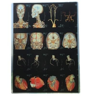 Low Price Color Printing Medical X-ray Film