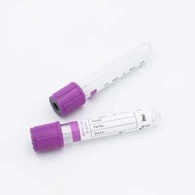 Medical Disposable Vacuum Pet EDTA-K2 Blood Collection Tube