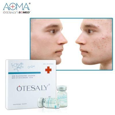 50ml Medical Grade Hyaluronic Acid Injectable Mesoterapia Serum Otesaly Price