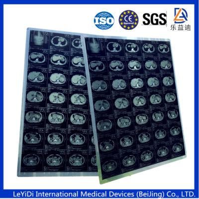 Ultrasound Film/ Medical Film/X-ray Film