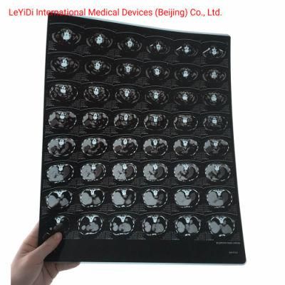 Brand Quality Dry Inkjet Printing Imaging Medical X-ray Film