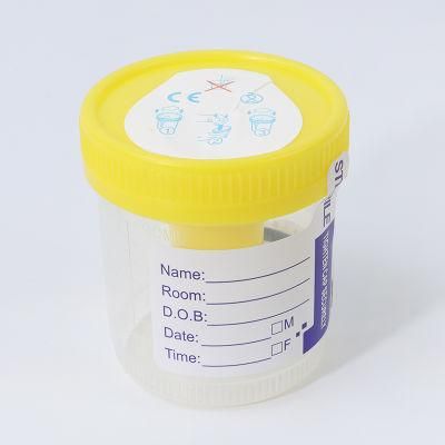 New Style Sterile Urine Test Sampling Plastic Container Cup