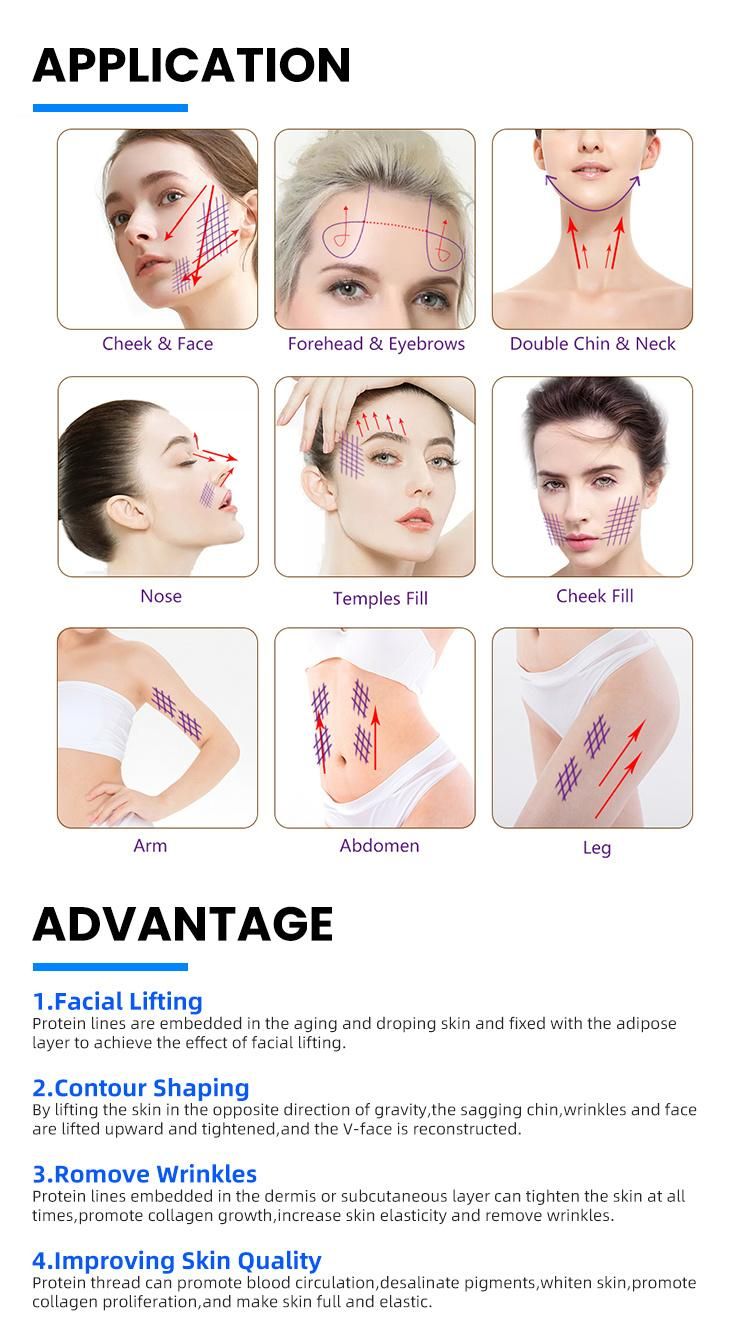 China Supplier Anti-Aging 29g 38mm Single Aptos Suture Mono 4D Cog Pdo Collagen Thread Korea for Facial Beauty