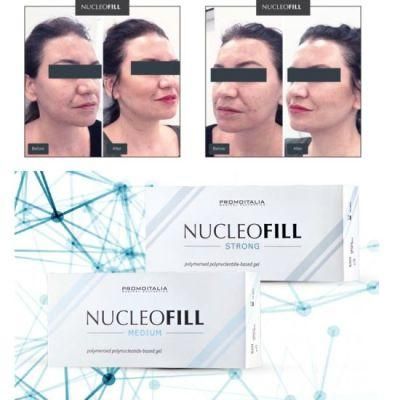 Hot Sale Nucleofill Strong Cleansing Effect Pn2.5% Seven-Point Lift on Lifting Antioxidant Hydrating Skin Regeneration Filler