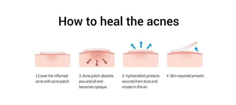 Hb16 Large Acne Patch - Absorption Concentrate Pack, Invisibility, Spots, Hydrocolloid, Comprehensive Skin Treatment, Facial Repair