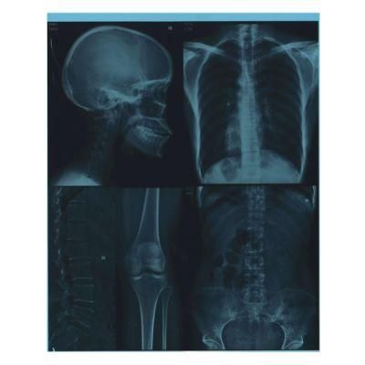 Inkjet X Ray Medical Dry Blue Imaging Films