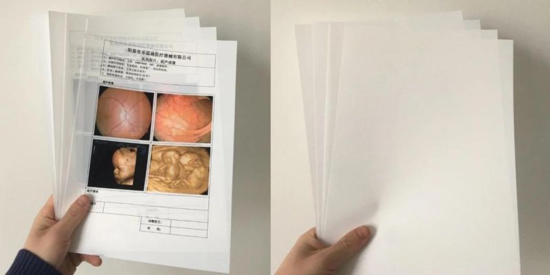 10*12 Inch Medical Laser Printing Film