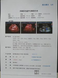 A4 125um Medical Dry Ultrasound Porcelain White Hospital Laser Film