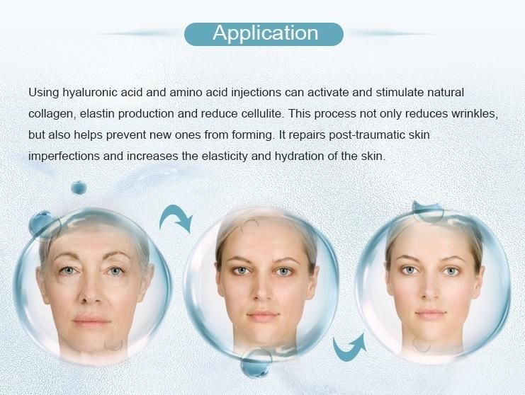 Long Lasting Injectable Cross Linked Hyaluronic Acid Body Dermal Fillers for Forehead Lines Rhinoplasty Chins Eye Wrinkle Nose Cheeks Nasolabial Folds Injection