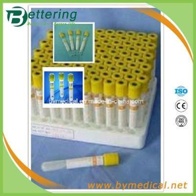 Yellow Cap Gel Vacuum Blood Tubes