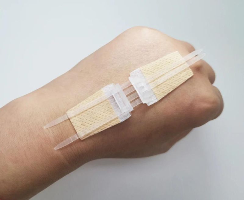 Surgical Wound Closure Plaster, Adhesive Wound Closure Device