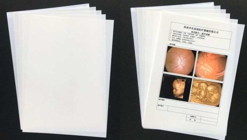 A4 and 11*14 X-ray Medical Film in Image Output Digital Printing