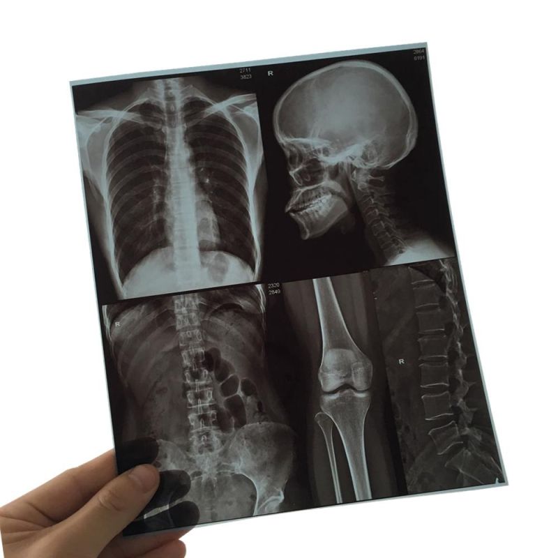 CT Machine 11X14 Inch Radiography Pet Blue X-ray Inkjet Film
