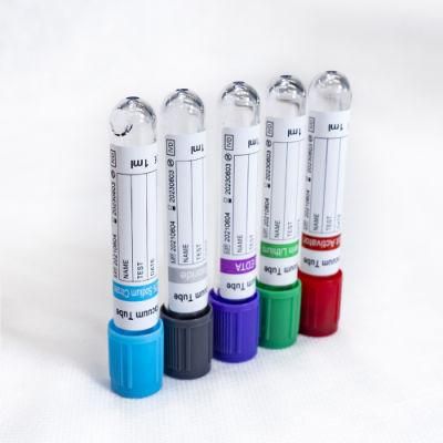 Medical-Grade Prp Vacutainer with Customized Size for Single Use Only