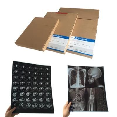 20X25 Cm Medical Dry Film Waterproof Inkjet Blue Film