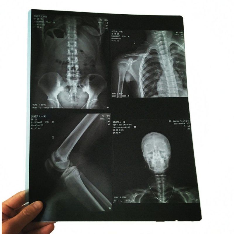 Cr, CT, MRI, Dr Machine Inkjet X Ray Film
